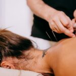 acupuncture