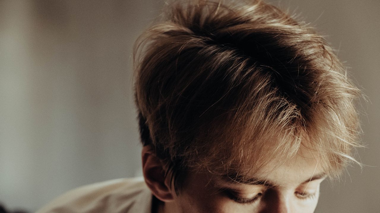 cheveux homme alopécie